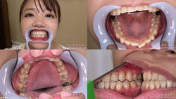【치아 페티쉬】 보물 메이의 치아를 관찰했습니다!