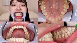 【歯フェチ】加賀美さらちゃんの歯を観察しました！