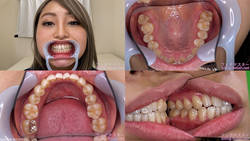 【치아 페티쉬】시시키 쿠루미의 치아를 관찰했습니다!