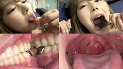 [Tooth / uvula] Observing the teeth and uvula of popular actress Ranran Chan! !!
