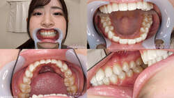 【歯フェチ】沙月恵奈ちゃんの歯を観察しました！