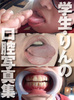 【世界先行発売】学生・りんの口腔写真集「足の指舐めるのって変な感じ……」編