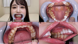 [Tooth Fetish] I observed Yuzu Shirakawa&#39;s teeth!