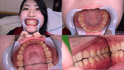 [치아 페티쉬】 기리하라 미오 짱의 치아를 관찰했습니다!